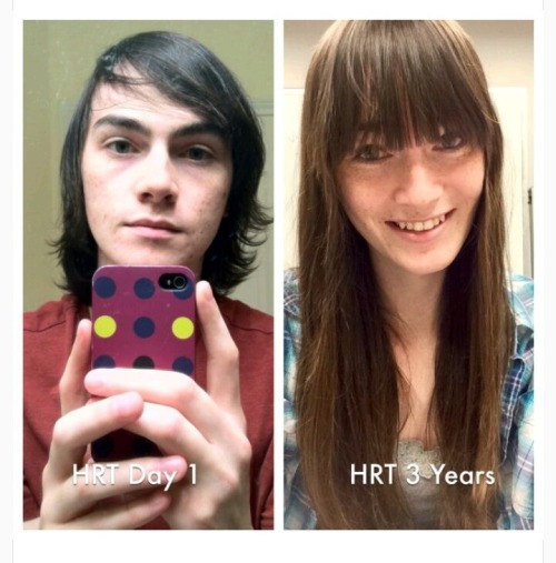 egybigcock:  lovecourts:  Aren’t hormones wonderful? These guys look great now!  OMG  find you