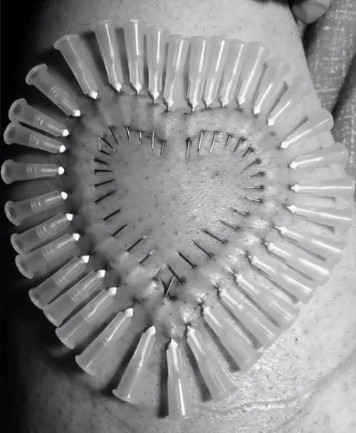 keres-nirvana:  masterzack52:  It’s like I tell everyone, sadism is an art. It’s really beautiful when done right, isn’t it?  Oh wow I would love to have art work such as these done to me,doing it to yourself just isn’t as satisfying as someone