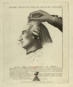 deathandmysticism:  Decapitated head of Louis