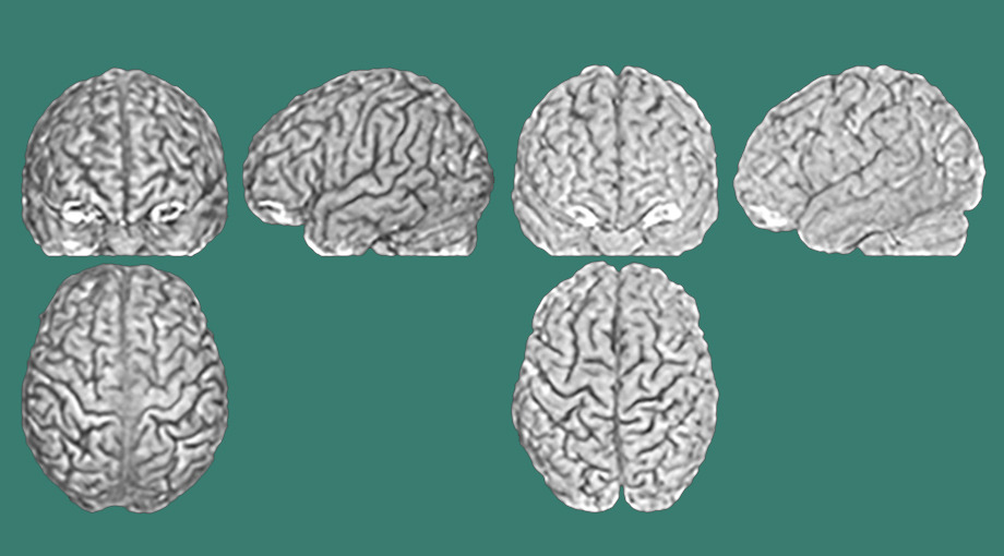Цветок похожий на мозг. Мозг спереди. Плоды дерева похожие на мозг. Мозг похожие предметы. Brain vs brain