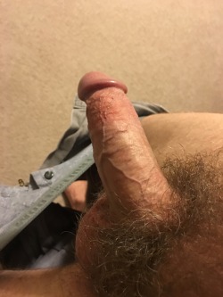 straightcuriousbuds:  Should I shave it or