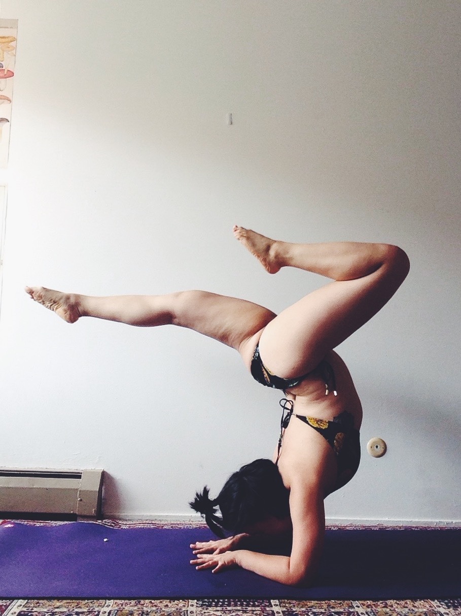 moonrootslily:  queenchante:  I have stretch marks all over my legs and a flabby