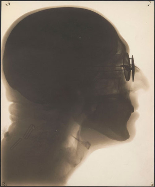 les-sources-du-nil: Dain L. Tasker (1872-1964) Self-Portrait, Radiograph, circa 1930’s