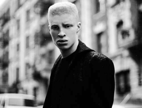 “People with not just albinism but all sorts of different people in general exist on an everyd