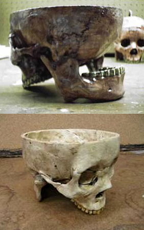 vesago1:These are the bowls made by Ed Gein from the skulls of his victims vesago1: These are the bo