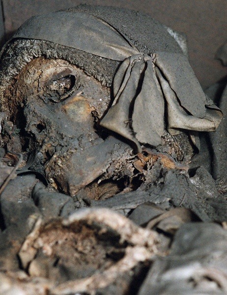 Lady of the Krakow Crypt, 1787. A woman who was poisoned by her father on her wedding day for marrying a man he disapproved of. She’s still in her wedding dress.