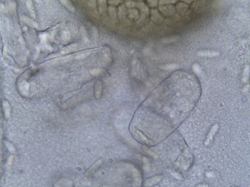 Ampelomyces quisqualis -hyperparasite fungus producing conidiospores (small spores) on its host fung