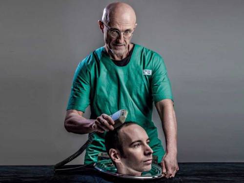 neuromorphogenesis: Human head transplant to occur in 2017 – will it work? A date has now been