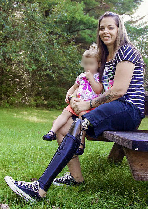 Army captain lost her leg above the knee