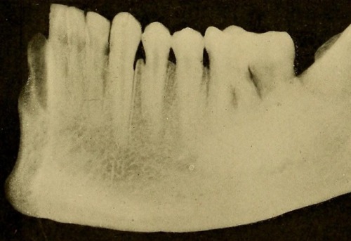 deathandmysticism: A system of instruction in X-ray methods and medical uses of light, hot-air, vibr