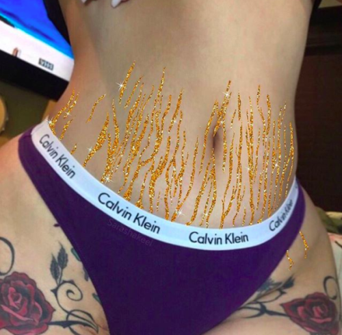 wetheurban:  Sara Shakeel Turns Stretch Marks Into Glittery Works Of Art “accidental” collage artist Sara Shakeel reveres stretch marks by filling them with glitter. They are, after all, symbols of a women’s experience and growth—so why shy them? 