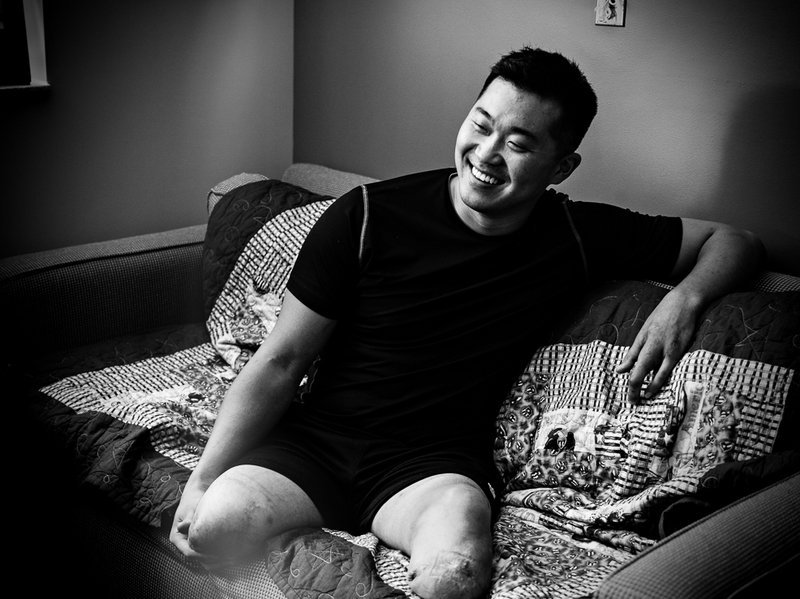 npr:  It’s impolite to stare. But when it comes to severely injured soldiers, maybe