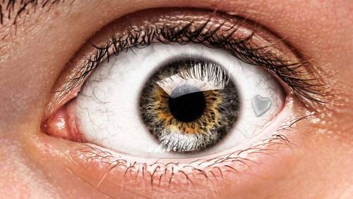XXX sixpenceee:  An extraocular implant is photo