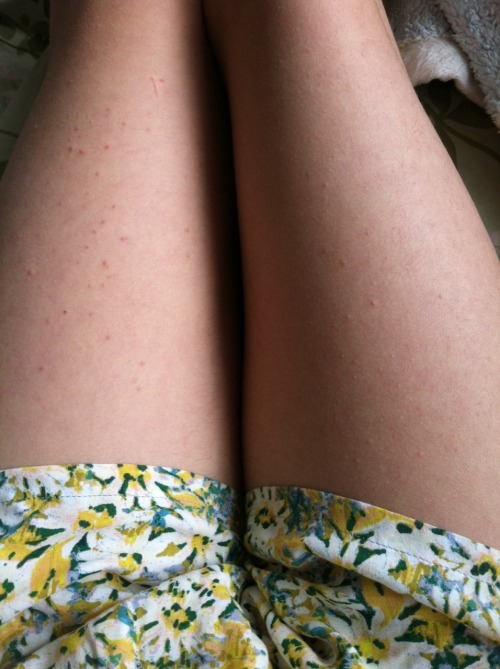 tumblr photo ttngay 0