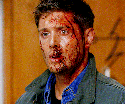 JENSEN ACKLES As DEAN WINCHESTER Supernatural | I Think I'm Gonna Like It Here (9.01)