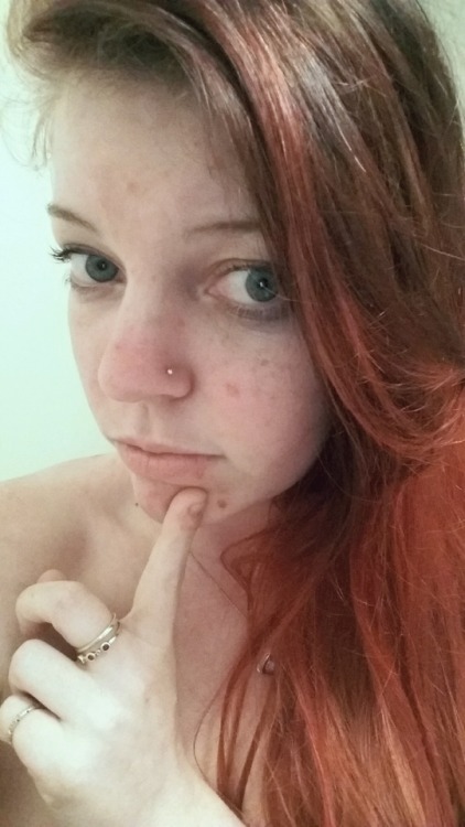 sweet-speckles: Challenge: leave the tiny spot alone My body flipped out this week and I got my peri