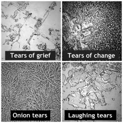 sixpenceee:  Artist Rose-Lynn Fisher began this project of analyzing different types of tears under a light microscope. It’s definitly interesting. But keep in mind this is an ART project. I do not know the scientific verification behind her work. 