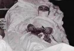 corporisfabrica:  queenspooky138:  In 1961, Leonid Rogozov, 27, was the only surgeon on the Soviet Antarctic Expedition. During the expedition, he felt a severe pain in his abdomen and had a high fever. After examining himself, he found that his appendix