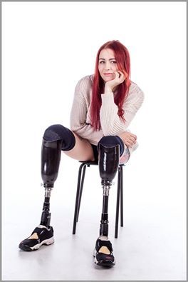 Stacy Paris, model who lost both legs below the knee due to infection.  She’s pretty amazing.