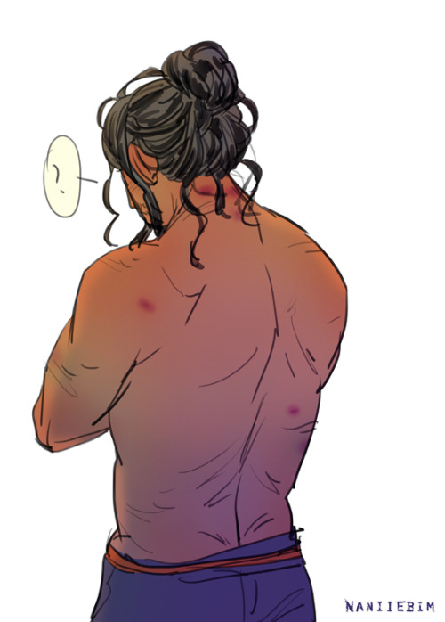 naniiebimworks:Baze Malbus (The “other guy.”)Bruises?