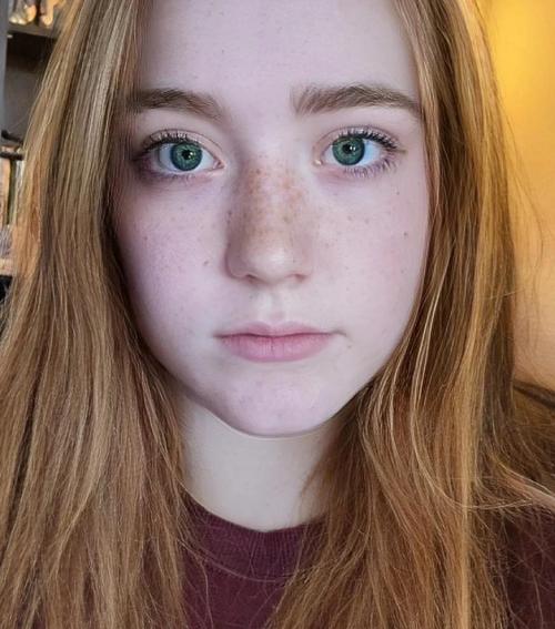 redhead-beauty:Freckle Friday