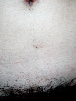 baretobush:  Day 155. Remember how I made this big fuss about finally deciding to pluck the little stray hairs on my tummy? Well, apparently I have some seriously overachieving hair follicles, because they’re coming back! And they’re in almost exactly