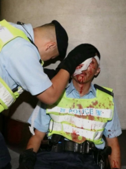 . . . . . . Never An Excuse For Violence.