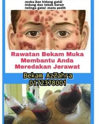 Pusat Bekam Azzahra Subang Bestari 0172378001