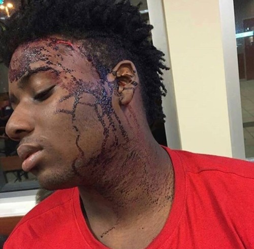 averageblackteen:  Black tumblr, reblog. This needs to be seen. 😔✊🏾 IG|@blackgirlmatter