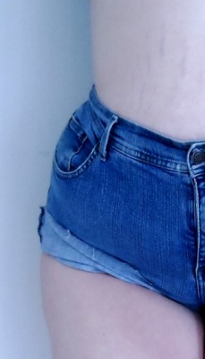 spookybabydoll:  My stretchmarks are as cute