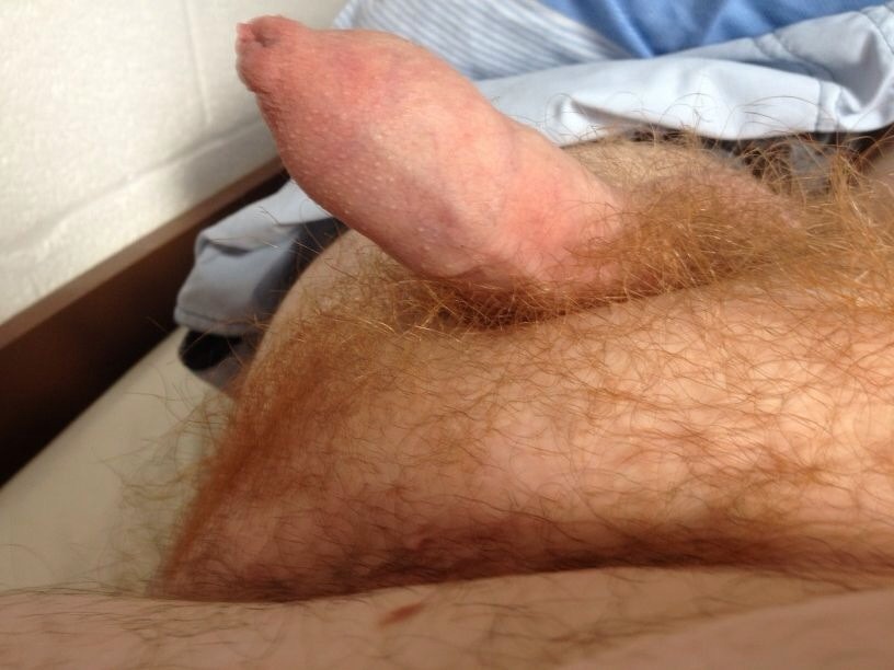 Ginger uncut bears are hot as hell. :)