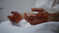 handsonfilm:  The knick - They capture the heat (S01E05) - 2014