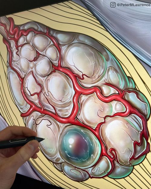 Just drawing some spinal tumors this morning… #medicaljournal #brainscience #medicalassistant