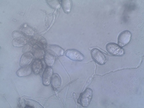 Germinating conidiospores of the fungus Golovinomyces cynoglossi (Erysiphales) on lungwort (Pulmonar