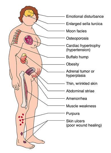 Adults with asperger syndrome