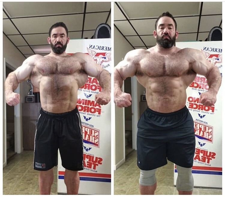 Cade Zook - From the post: Left is Jan I was 277lbs 3 months post tricep tendon surgery.