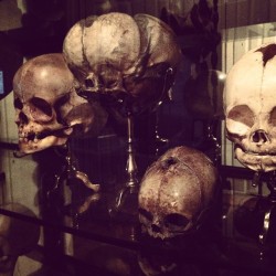 ryanmatthewcohn:  We die young. #oddities #fetal #skull #skulls 
