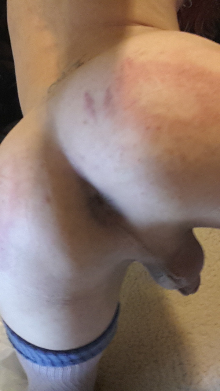daddyswolfbrat:  I got caned, whipped and paddled last night :) finally. Yay! Nakie