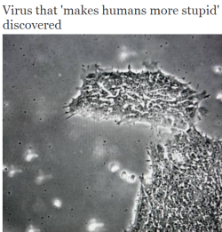 thinksquad:  A virus that infects human brains and makes us more stupid has been discovered, according to scientists in the US.  The algae virus, never before observed in healthy people, was found to affect cognitive functions including visual processing
