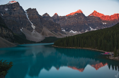 rachellaurenimagery: Moraine Lake - Different Light Instagram: rachel.lauren.imagery