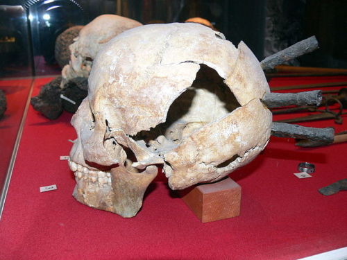 ta-ether: anthropolos: irisharchaeology: A human skull with three iron arrowheads embedded in it. It