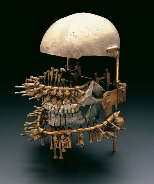 Model used for studying and treatment of jaw fractures. From the Institute of Dentistry,