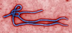 Electron micrograph of the Ebola Virion from the CDC public images & Wiki Commons.