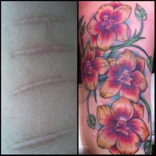 tattoo-queens:  skindeeptales:  Amazing scar covering tattoos  Tattoos can be for healing 