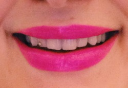 molotowcocktease:  Chipped teeth and pink