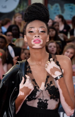 voguememoirs:  vsvptayty:  Winnie Harlow