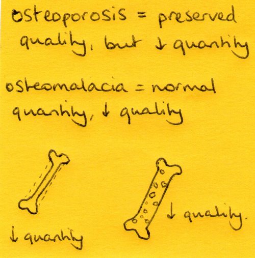 Osteoporosis vs osteomalacia (Another one of the things I tend to get confused about that no one els
