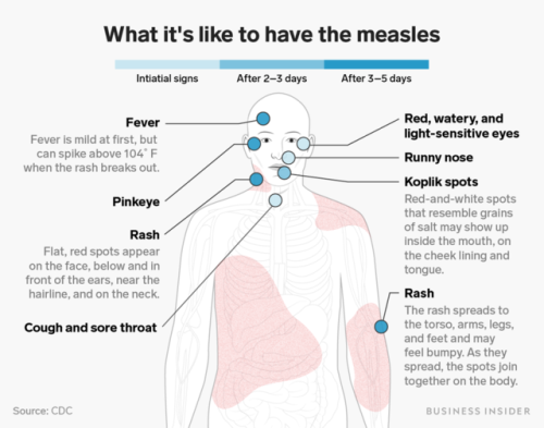 Tell-tale signs you or someone you know might have the measles