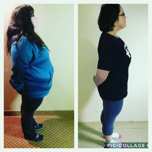 amandabear1979:Well here are some new before and afters March 14th 2016 vs Jan 4th 2017 I took off t