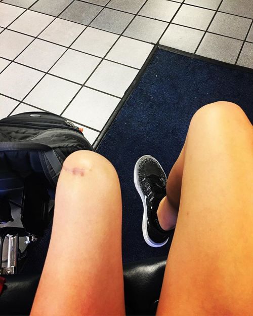 interdevo:A photoset about Kirstie Ennis prosthetic leg in converse shoe